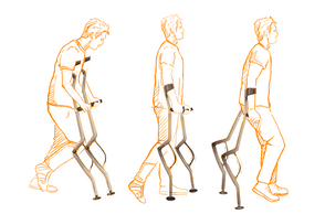 Dargestellt ist eine Skizze des Modularen Krückensystems bei der Anwendung.