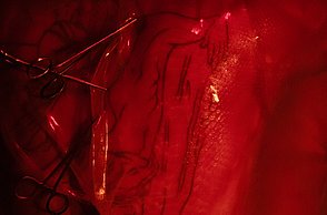 Im roten Licht sieht man den Rücker einer Person, welcher mit Scheren beschnitten ist